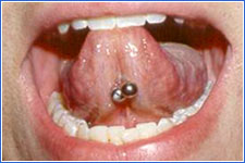 m2_oralpiercing1