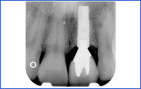  Ingeborg De Kok, DDS MS