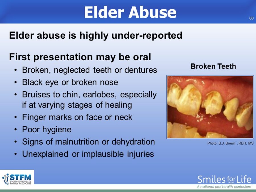 Module 8 Slide 60