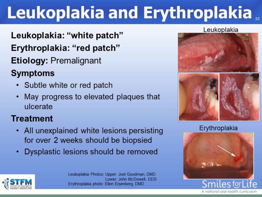 Module 8 Slide 32
