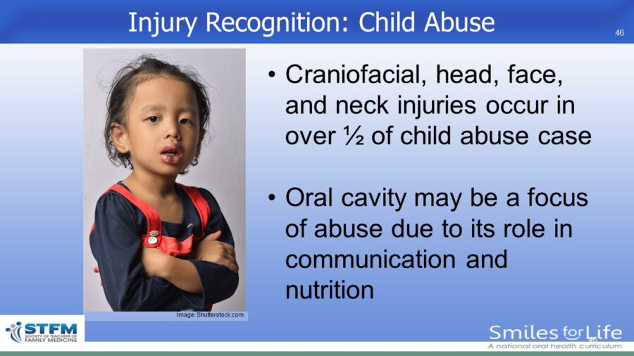 Module 2 Slide 46