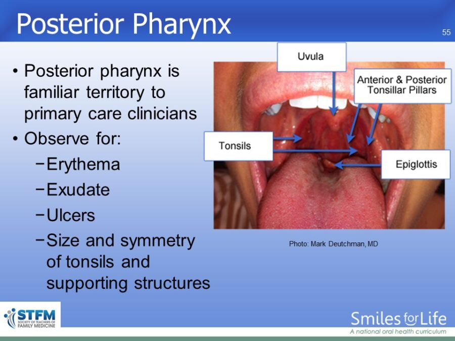 Module 7 Slide 55