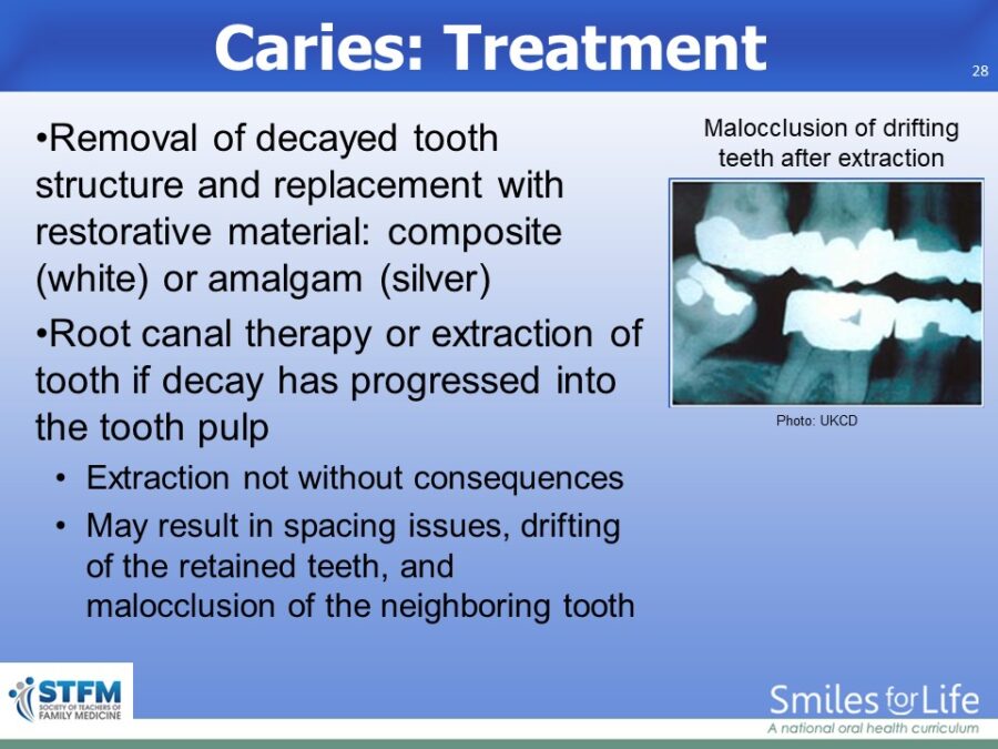 Module 8 Slide 28