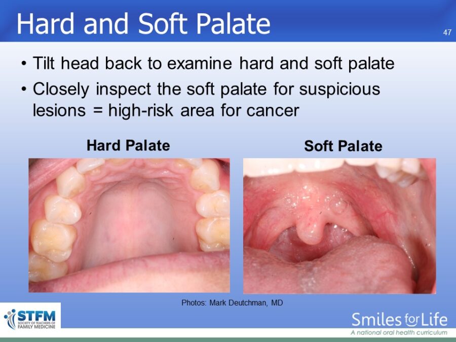Module 7 Slide 47