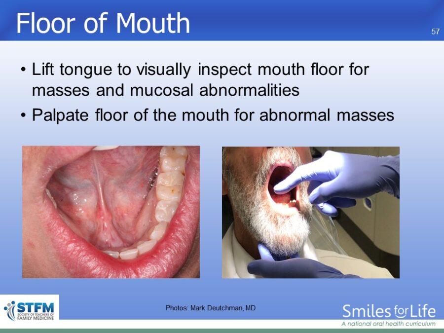 Module 7 Slide 57