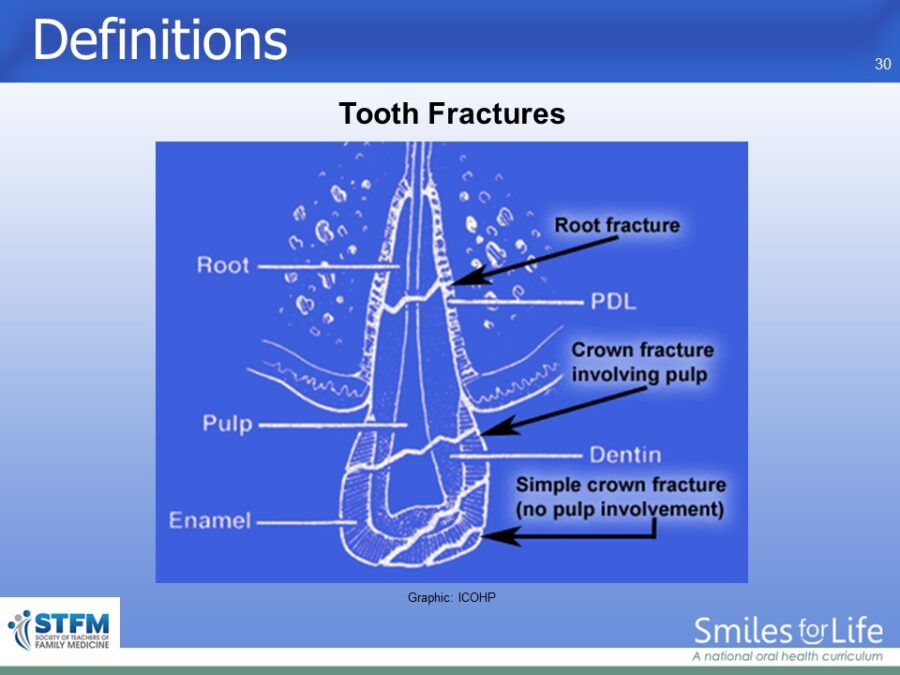 Module 4 Slide 30