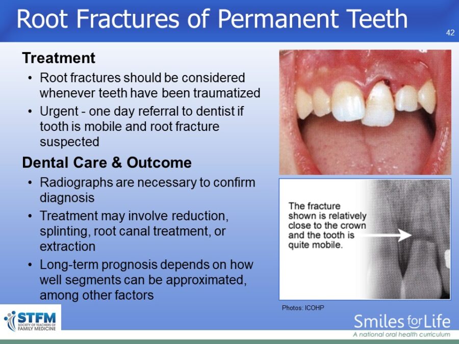 Module 4 Slide 42