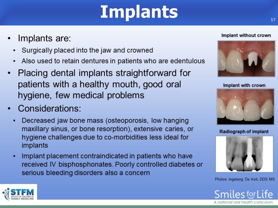 Module 8 Slide 17