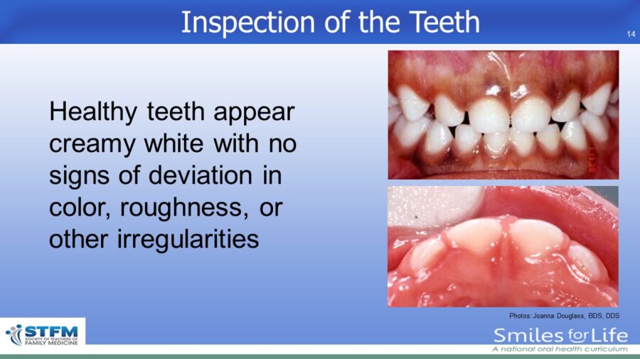 Module 2 Slide 14