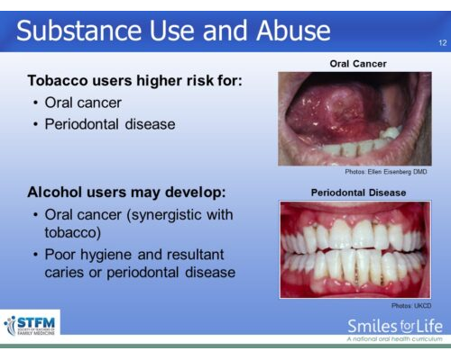 Module 1 Slide 12
