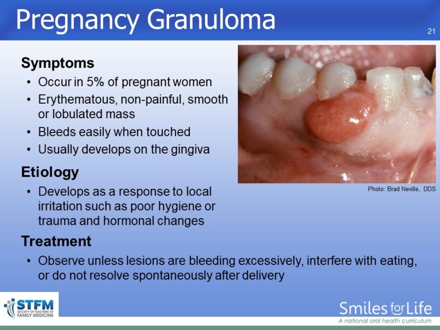Module 5 Slide 21