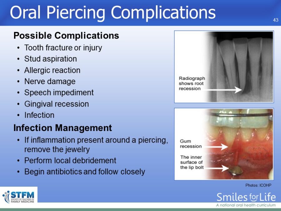 Module 4 Slide 43