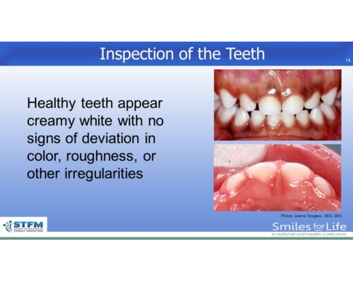Module 2 Slide 14