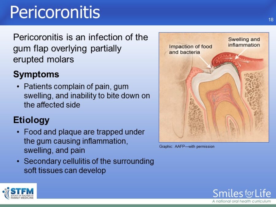 Module 4 Slide 18