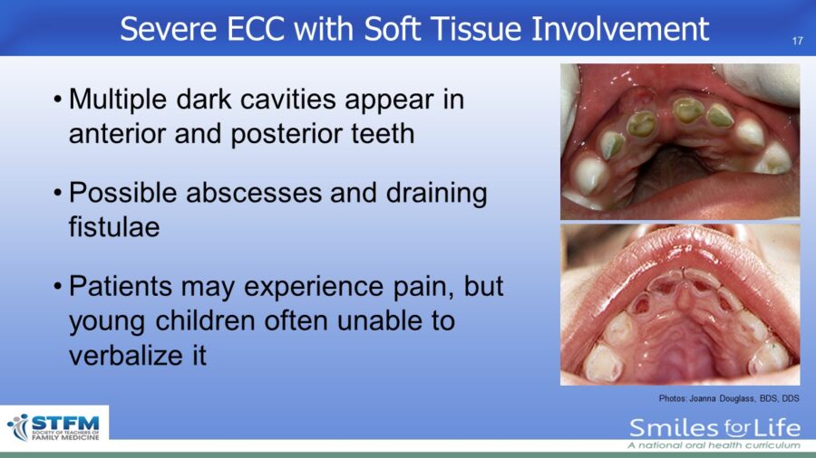 Module 2 Slide 17