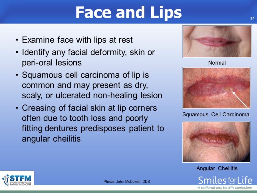 Module 8 Slide 14