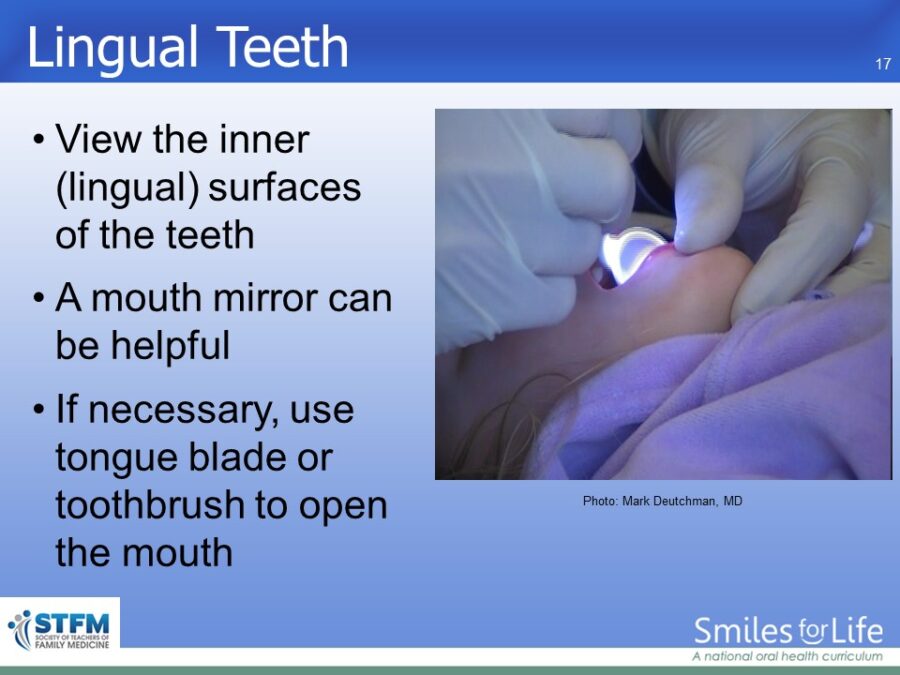Module 7 Slide 17