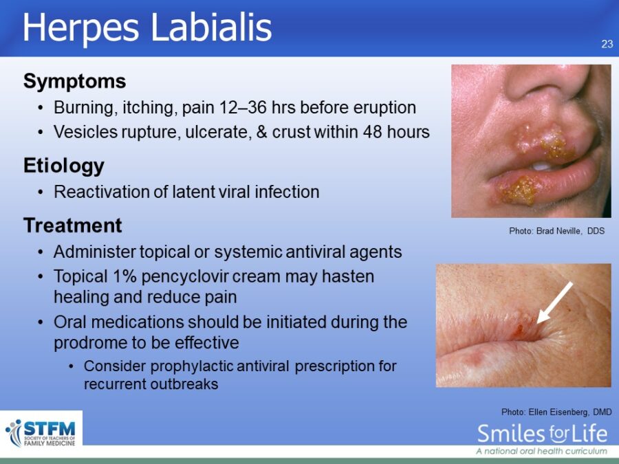Module 3 Slide 23