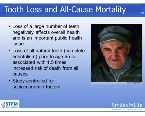 Module 1 Slide 29