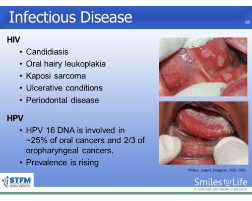 Module 1 Slide 28
