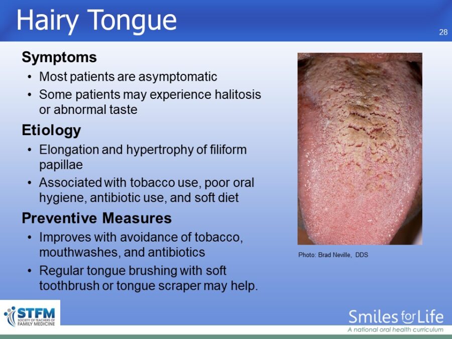 Module 3 Slide 28