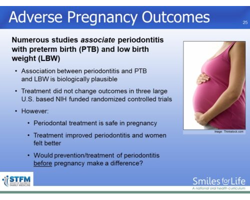 Module 1 Slide 25