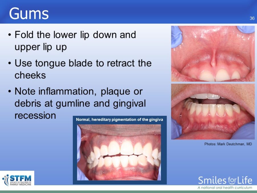 Module 7 Slide 36