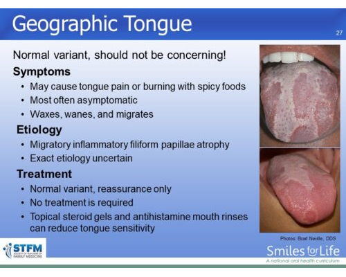 Module 3 Slide 27