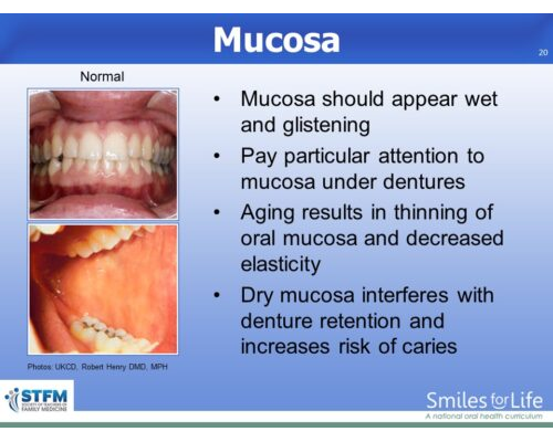 Module 8 Slide 20