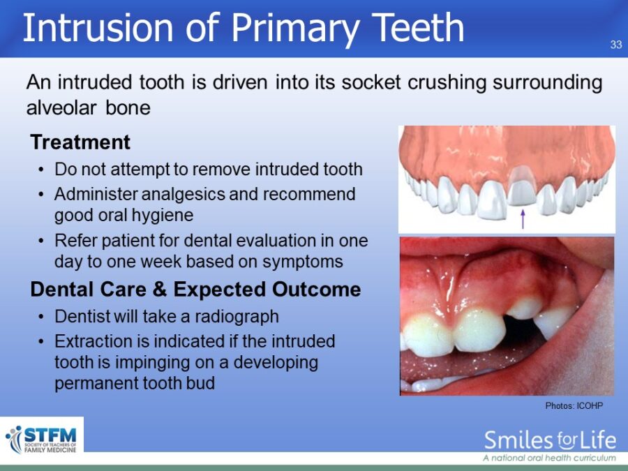 Module 4 Slide 33