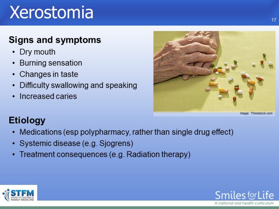Module 3 Slide 17