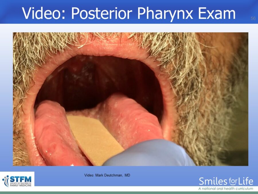 Module 7 Slide 56