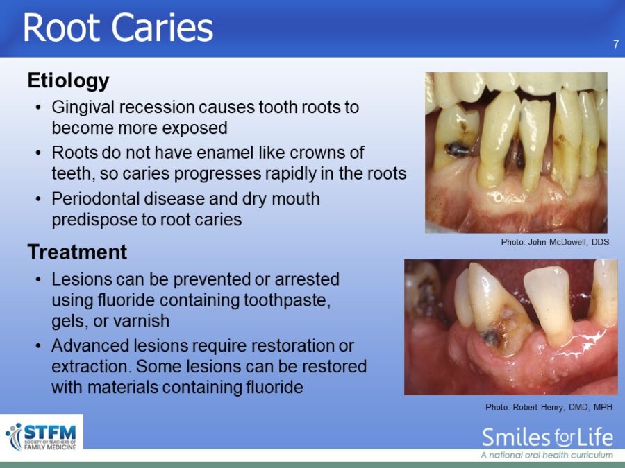 Module 3 Slide 7