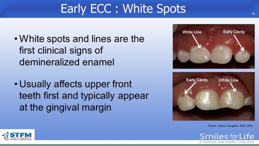 Module 2 Slide 15