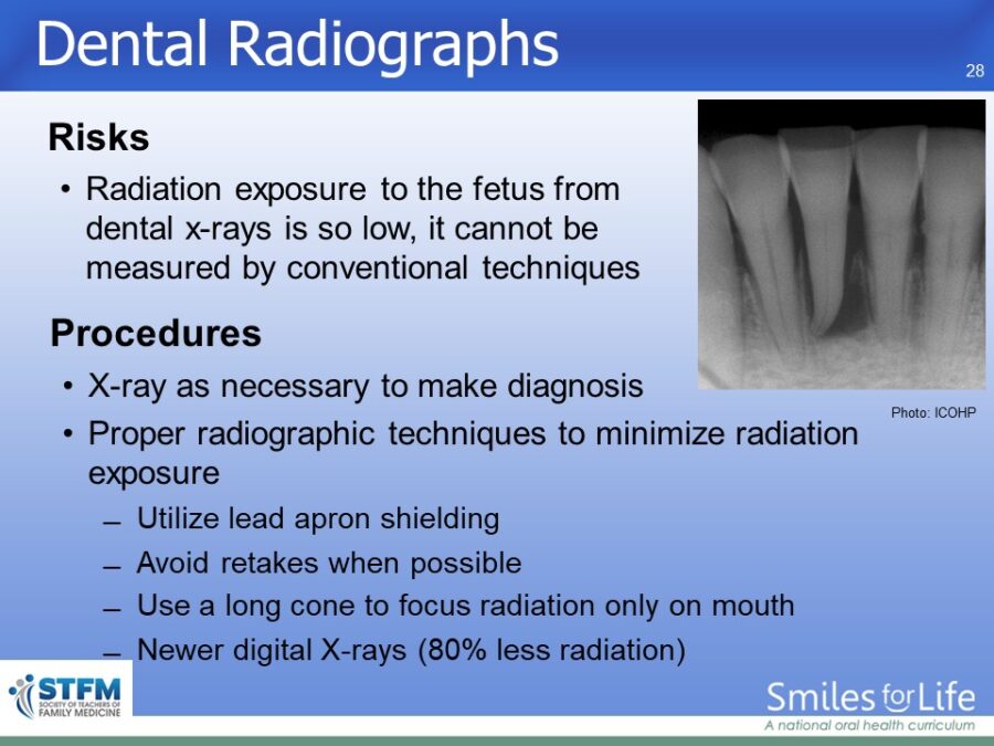 Module 5 Slide 28
