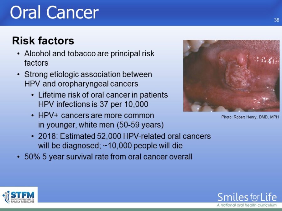 Module 3 Slide 38