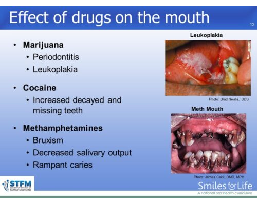 Module 1 Slide 13