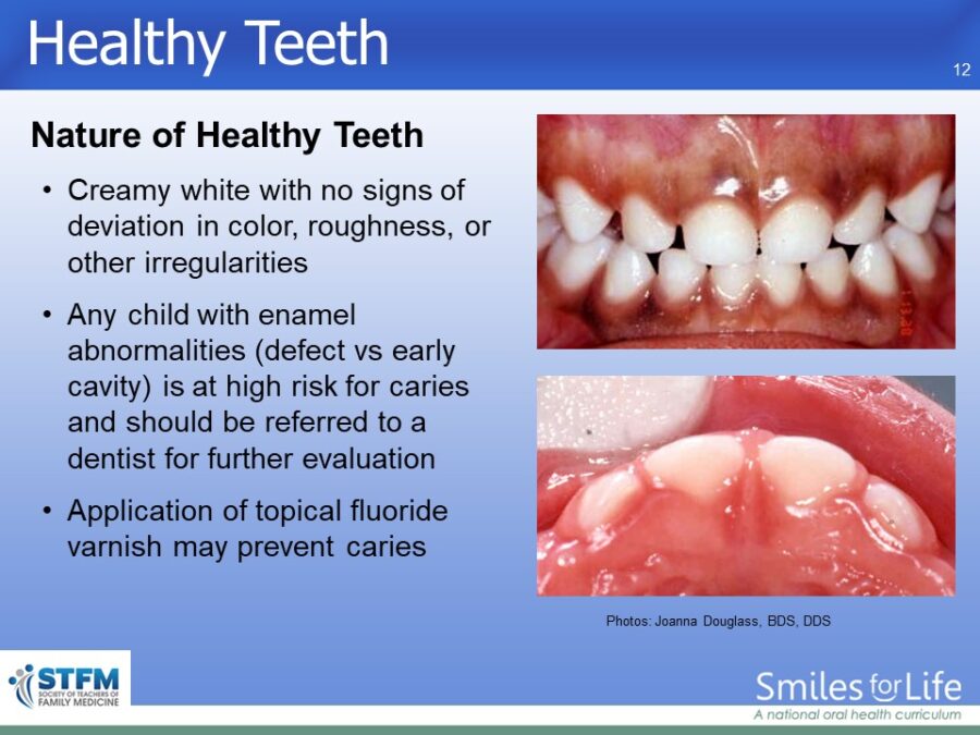 Module 6 Slide 12