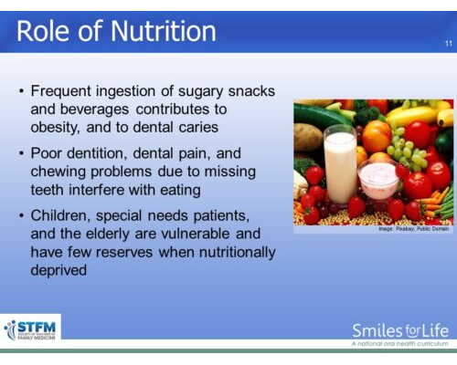 Module 1 Slide 11