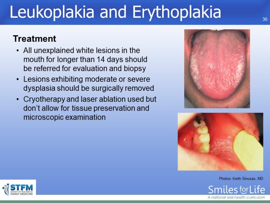 Module 3 Slide 36