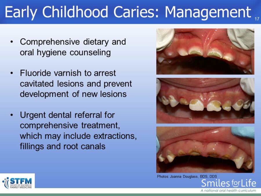 Module 6 Slide 17