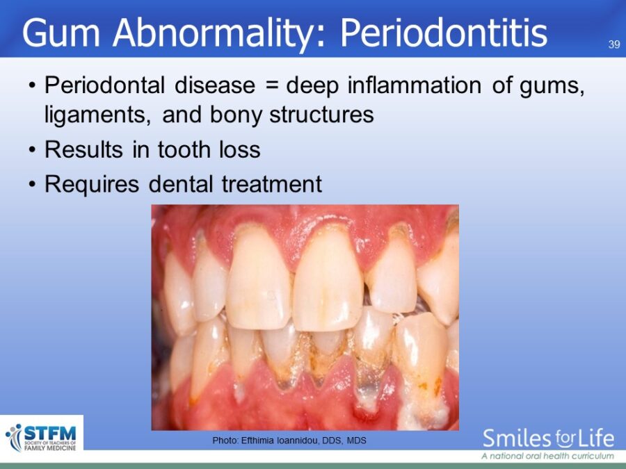 Module 7 Slide 39