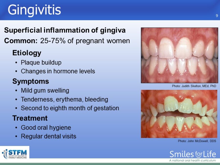 Module 5 Slide 9