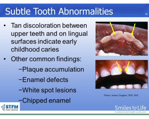 Module 7 Slide 18