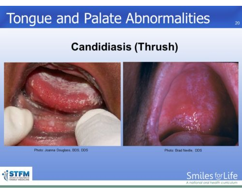 Module 7 Slide 20