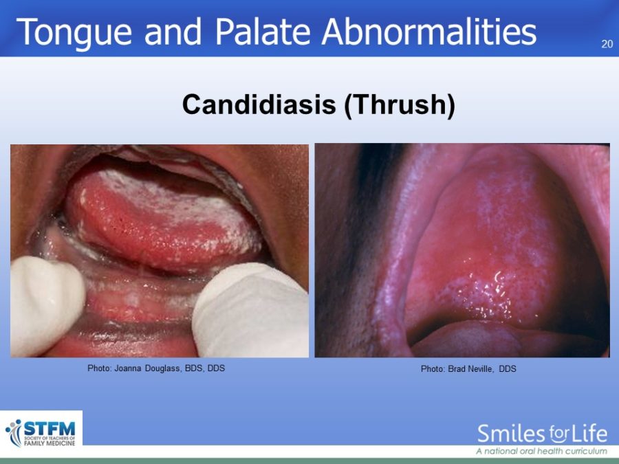 Module 7 Slide 20