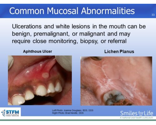 Module 7 Slide 33