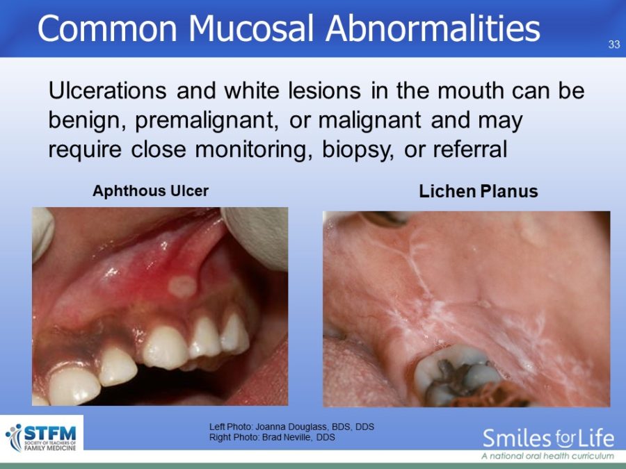 Module 7 Slide 33