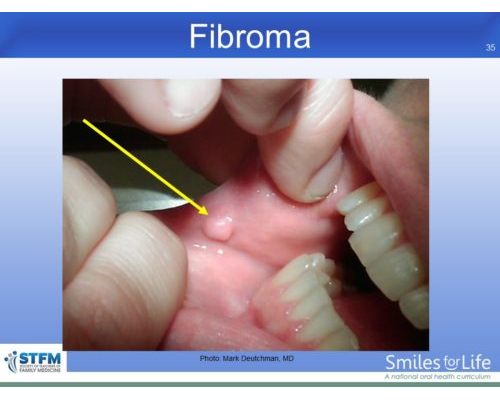 Module 7 Slide 35