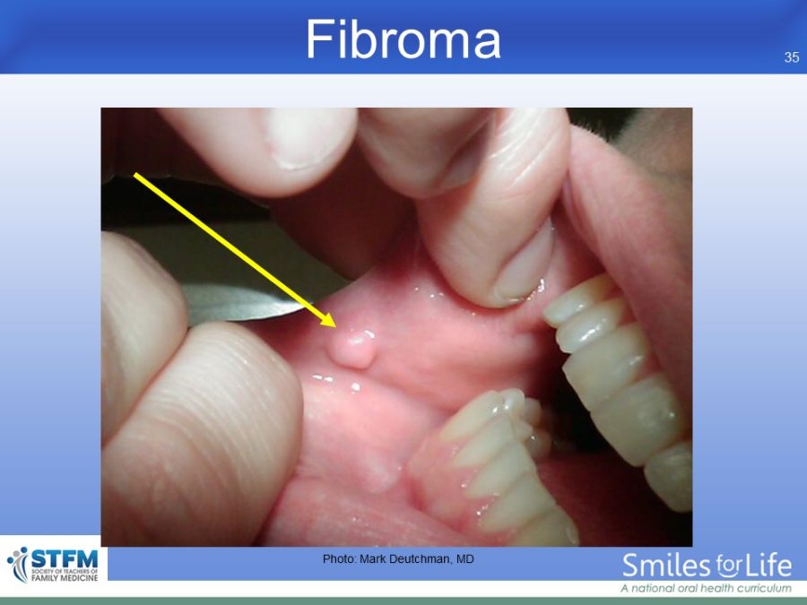 Module 7 Slide 35